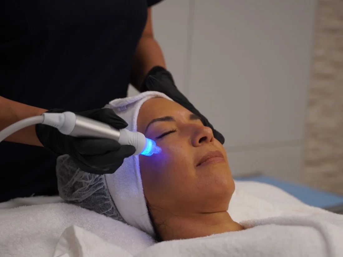 Blau leuchtender HydraFacial-Aufsatz auf der Wange einer Kundin im Beauty Rocío Luzern