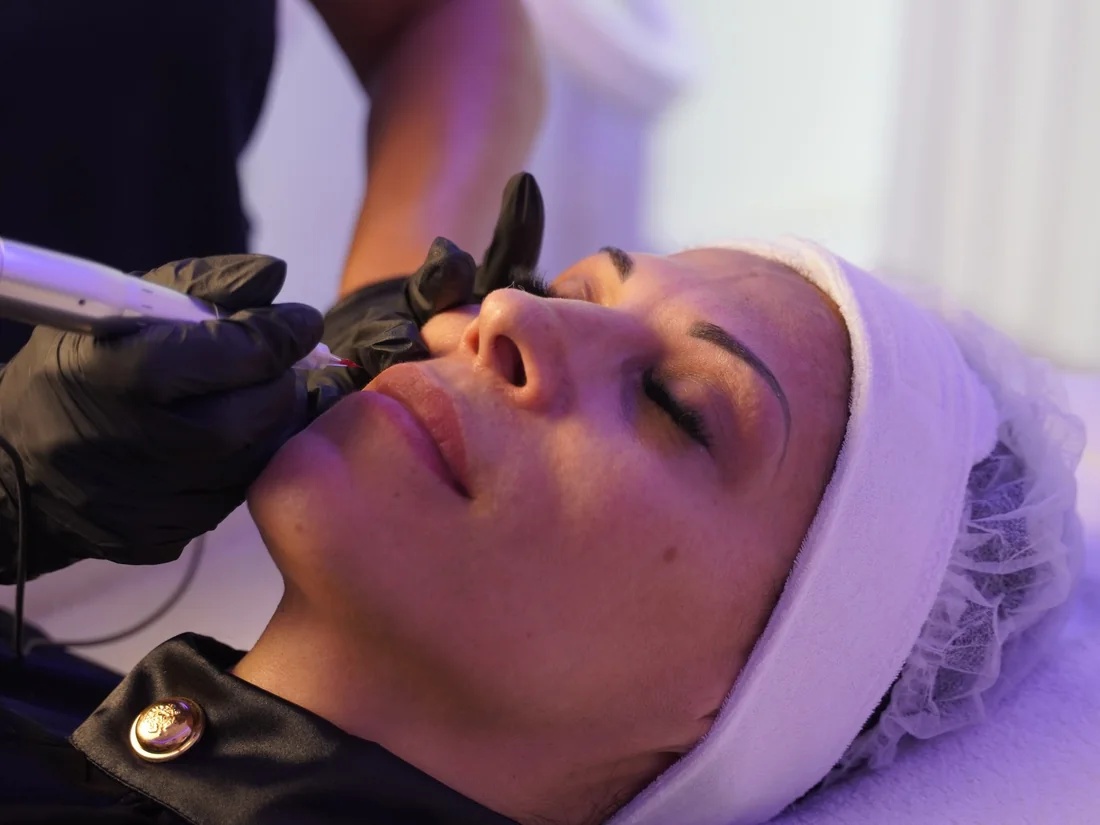 Permanent Make-up an der Lippe einer Kundin im Beauty Rocío Luzern