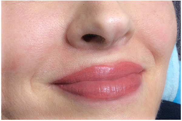 Permanent Make-Up_Lippen_Nachher_Beauty Rocio